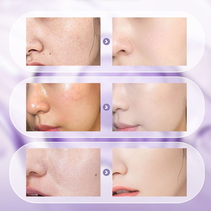 🎉Summer Hot Sale--49% Off🎉All-in-One Niacinamide Cream