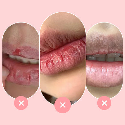 🎉2025 Hot sale!🔥10g Ultra-Hydrating Lip Glowy Balm