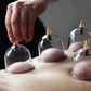🔥Hot Sale - 50% OFF🔥Thickened Vacuum Cupping Set with Suction Pump
