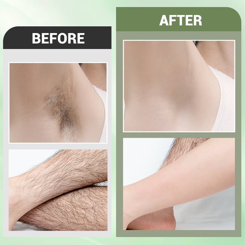 3PCS Hair Removal Cream Set for Full Body